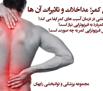 فیزیوتراپی کمر