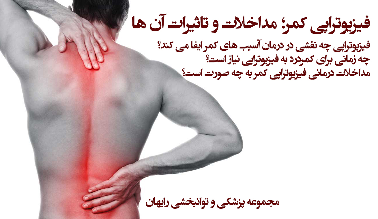 فیزیوتراپی کمر