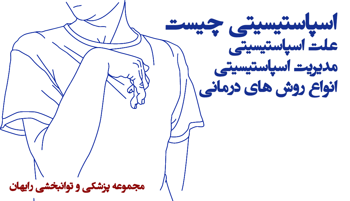 اسپاستیسیتی