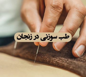 طب سوزنی در زنجان