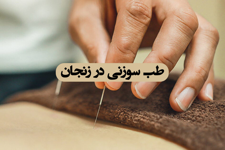 طب سوزنی در زنجان