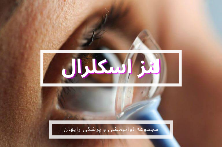 لنز اسکلرال